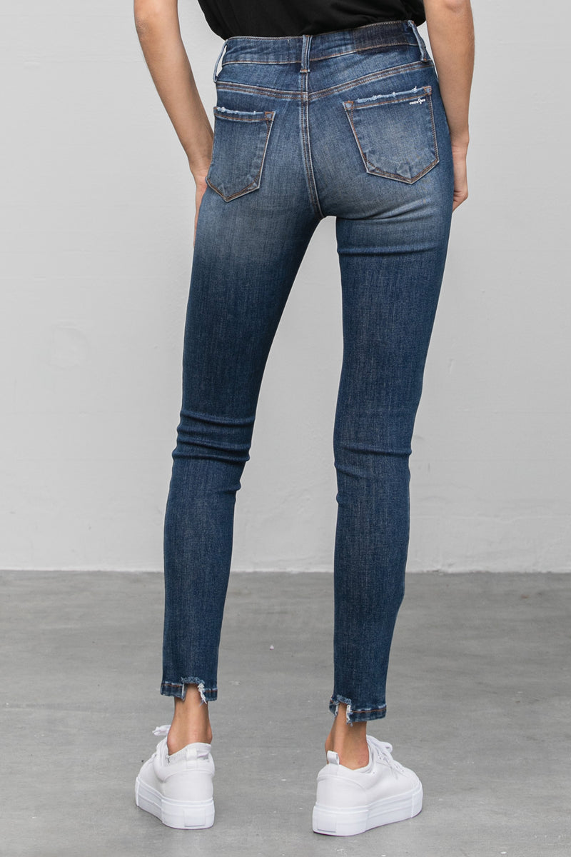 Youknow Ankle Skinny Jeans - Insanegene.com